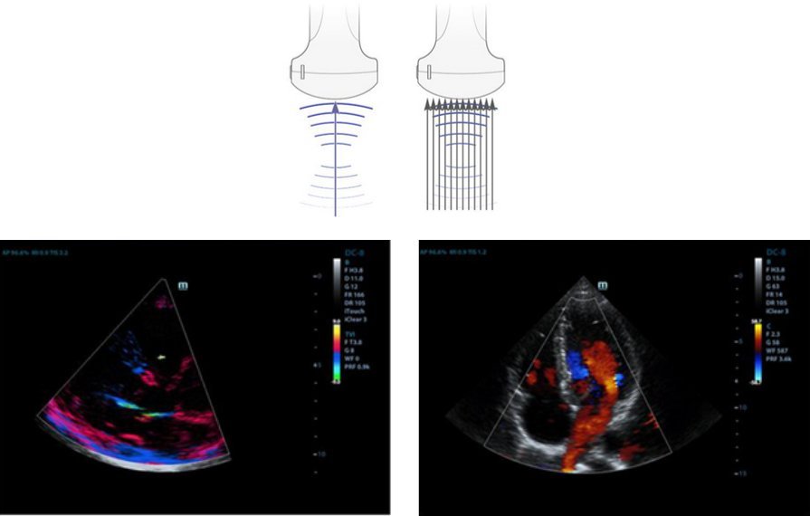 Mindray M9 Ultrasound System - Premium Imaging with Advanced Transducer Technology