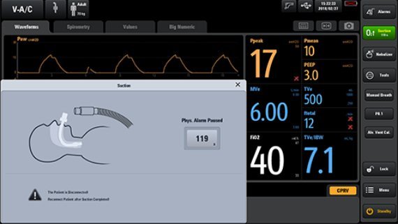 SV800/SV600 High-End Ventilator with Advanced User Interface and Intelligent Decision Support Tools for Clinical Efficiency and Lung Health Monitoring