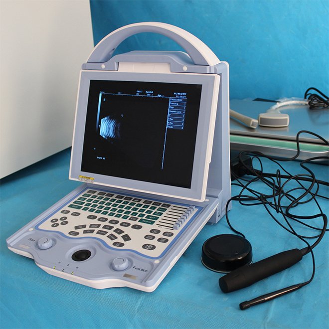 Ophthalmic Ultrasound Scanner NEUPU23