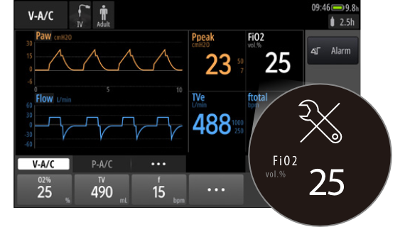 TV80 Portable Transport Ventilator with Advanced Patient Monitoring, Oxygen Management, and Telemedicine Capabilities