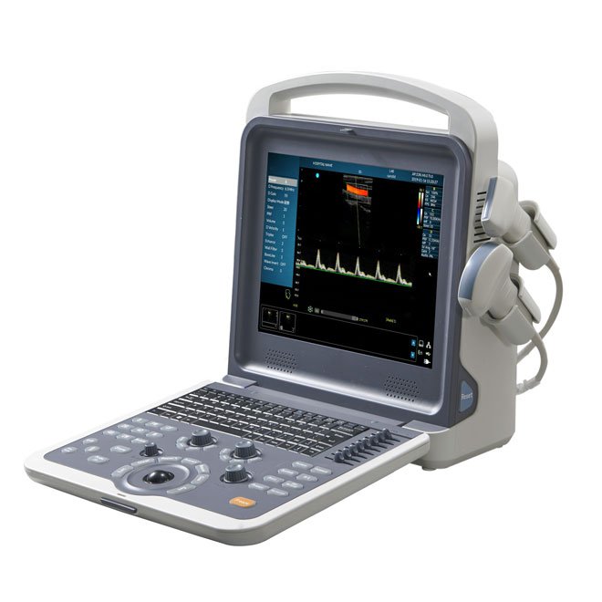 Portable Color Doppler Ultrasonic Diagnostic System NEUCU62