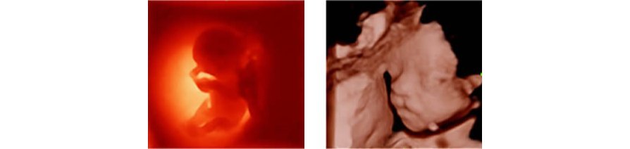Z50 Color Doppler Ultrasound Machine