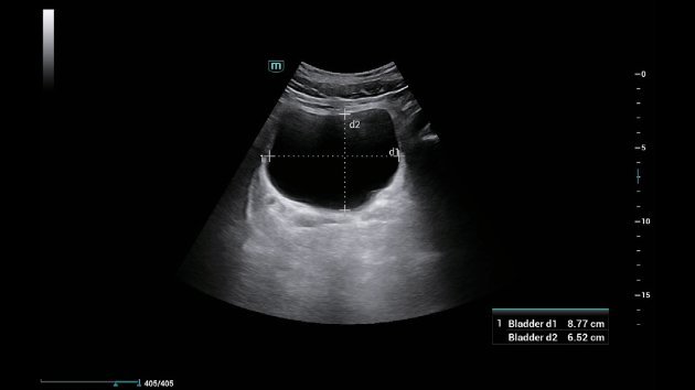 Consona N6 Comprehensive Imaging Solutions - Advanced Ultrasound Technology for General Imaging, Women's Health, and Cardiovascular Applications
