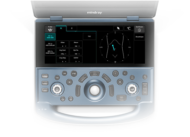 MX7 Ultrasound System - Advanced Mobile Imaging Solution