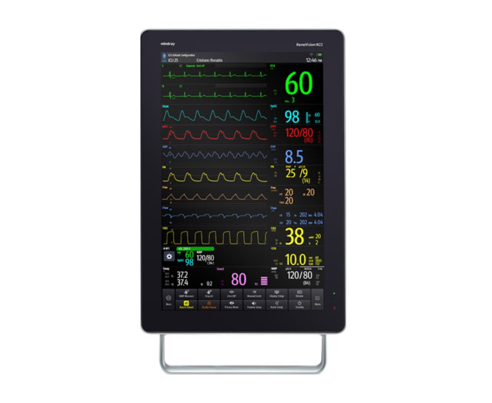 BeneVision N22/N19 Patient Monitor - Advanced Clinical Monitoring Solutions by Mindray