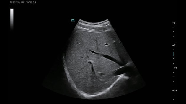 Consona N8 Diagnostic Ultrasound System - Advanced Imaging Solutions for Healthcare Professionals
