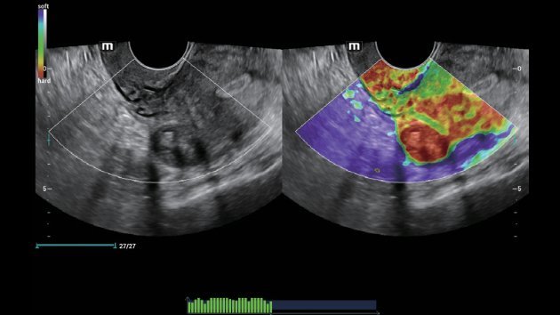 Nuewa I9 Elite Edition - Advanced Diagnostic Ultrasound System for Women and Neonatal Healthcare