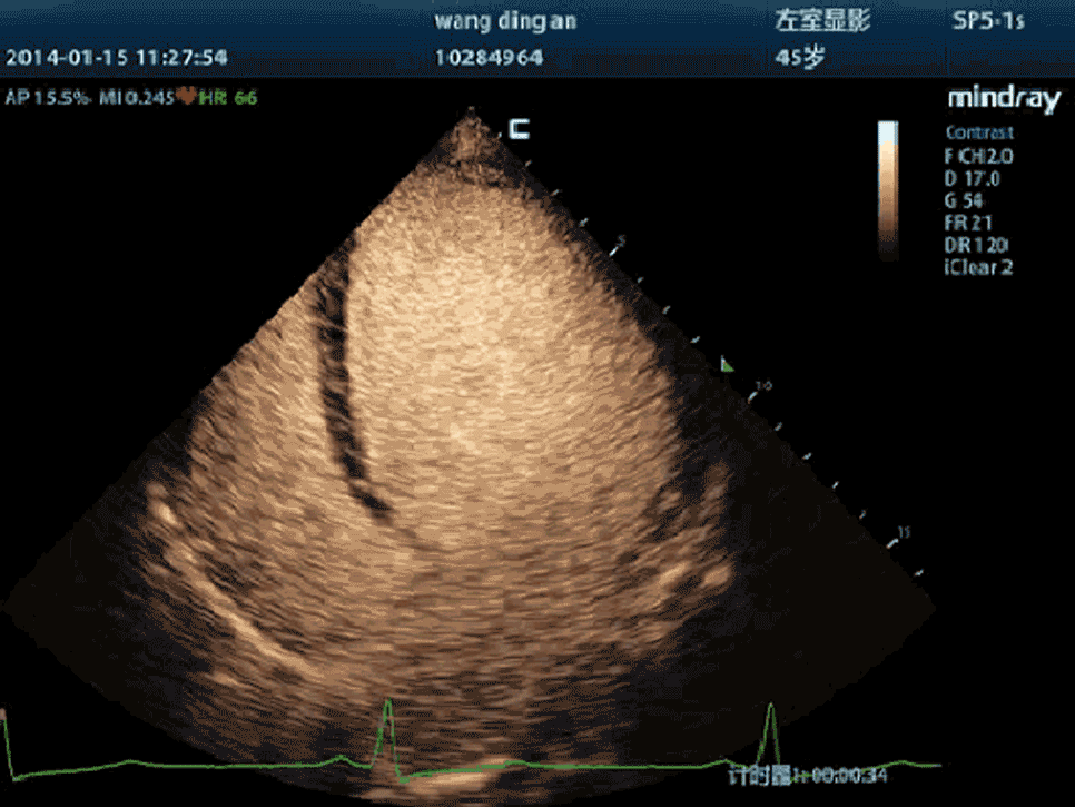 Mindray M9 Portable Ultrasound System - Advanced Imaging and Diagnostic Solutions