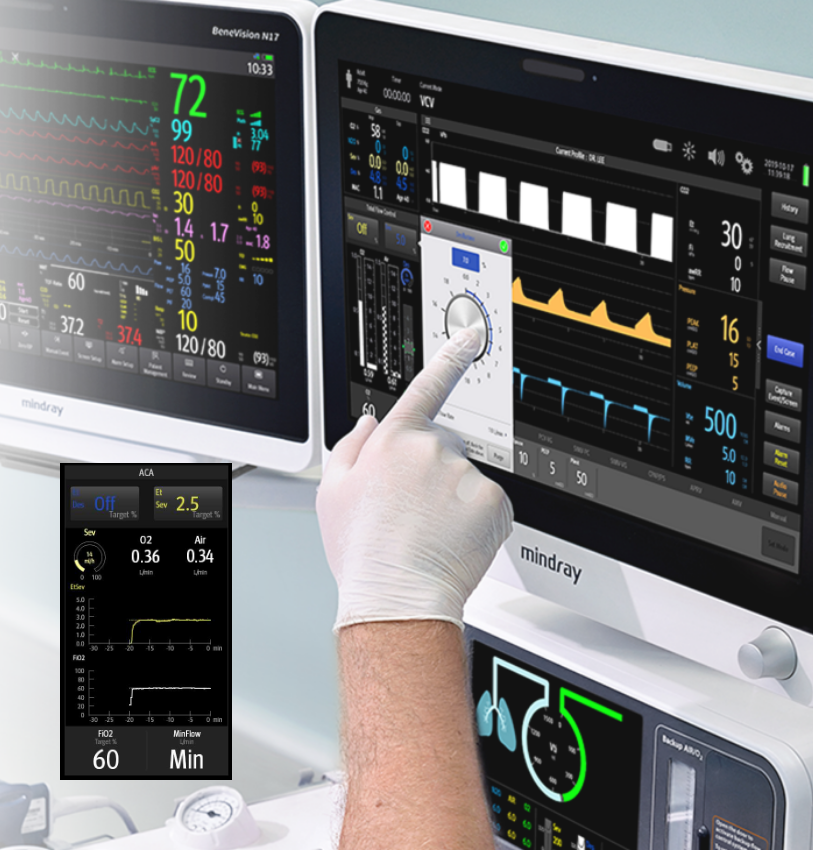 A9 Anesthesia Machine with Touchscreen, Electronic Flowmeter, and Automatic Controlled Anesthesia System