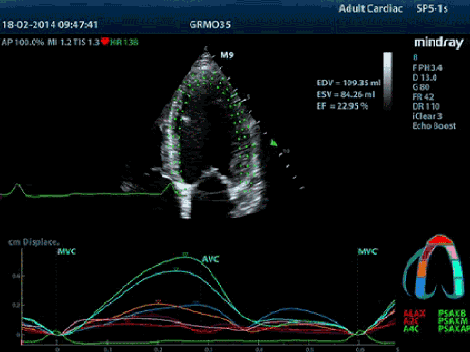 Mindray M9 Portable Ultrasound System - Advanced Imaging and Diagnostic Solutions