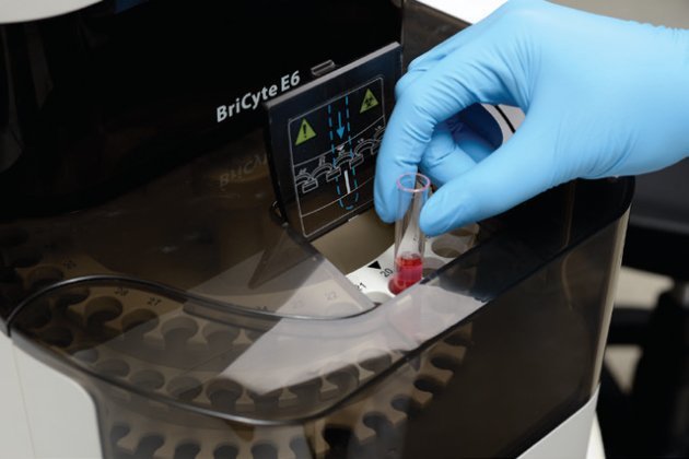 BriCyte E6 Flow Cytometer - Easy-to-Use with Advanced Features
