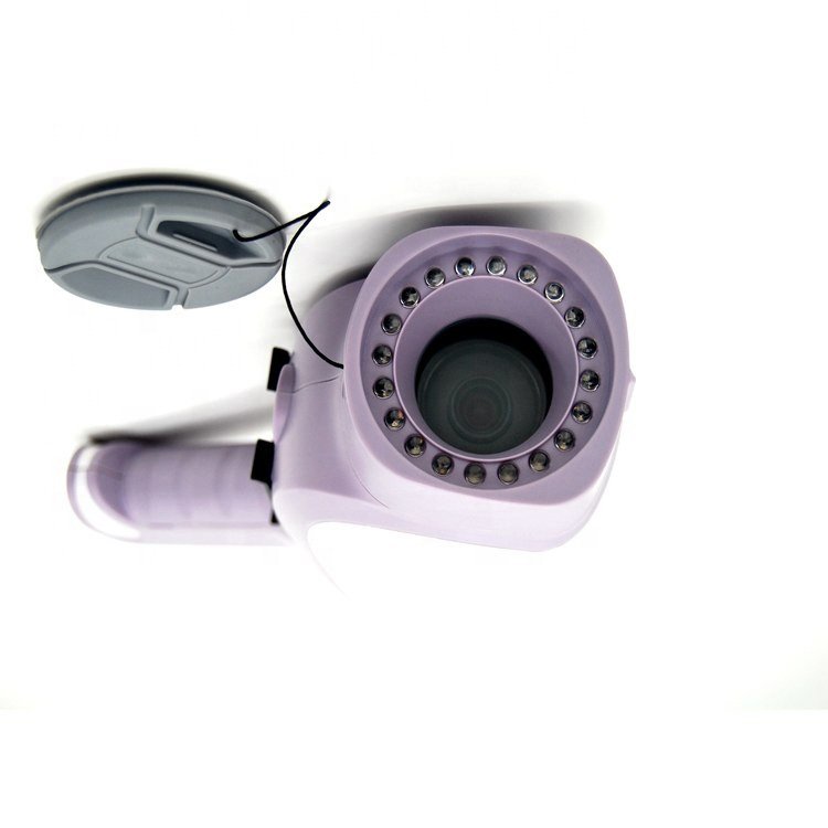Portable Gynaecology Digital Colposcope System NEUCE07
