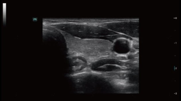 Consona N7 Comprehensive Imaging Ultrasound Device