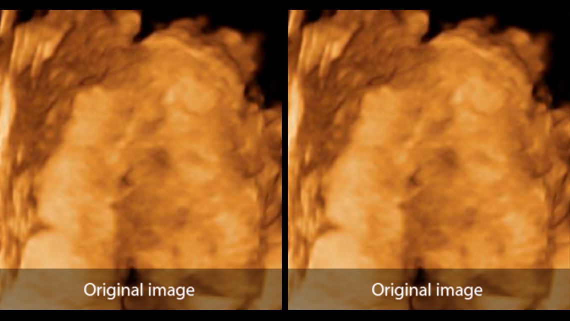 DC-40 Diagnostic Ultrasound System – Pure Crystal Technology for Primary Care