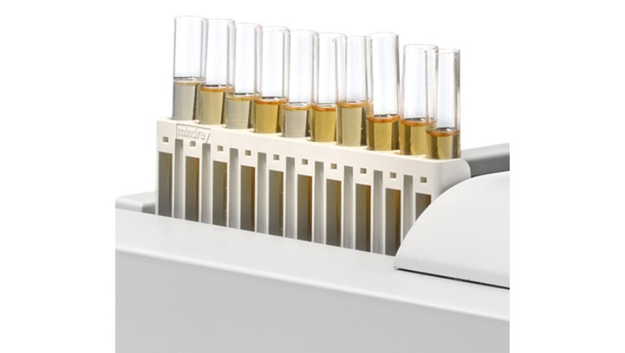 Automatic Urine Analyzer UA-5600 - High Precision Chemistry Testing for Proteinuria and Urinalysis