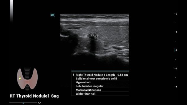 Consona N8 Diagnostic Ultrasound System - Advanced Imaging Solutions for Healthcare Professionals