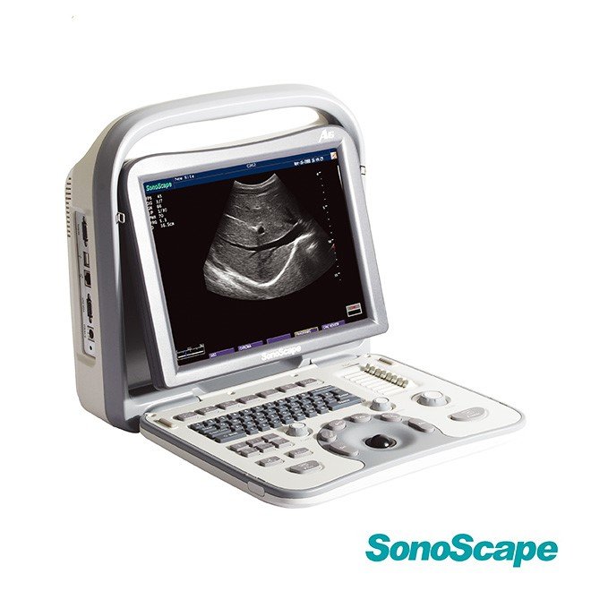 Ultrasound SonoScape A6