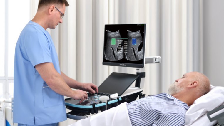 Resona I9 Diagnostic Ultrasound System - Advanced Imaging Technology for Clinical Solutions