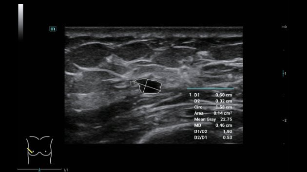 Consona N8 Diagnostic Ultrasound System - Advanced Imaging Solutions for Healthcare Professionals