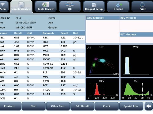Auto Hematology Analyzer BC-5150 - Compact 5-Part CBC Solution for Diagnostic Labs