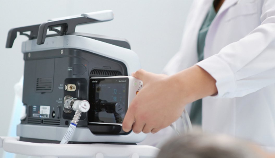 TV80 Portable Transport Ventilator with Advanced Patient Monitoring, Oxygen Management, and Telemedicine Capabilities