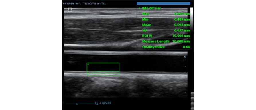 Z50 Color Doppler Ultrasound Machine