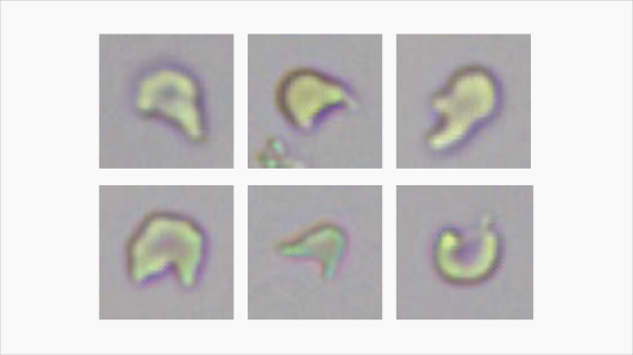 Automated Urinalysis System EU-5600 Pro/5300 Pro - Advanced Laboratory Analysis with 2K Imaging and Enhanced Efficiency