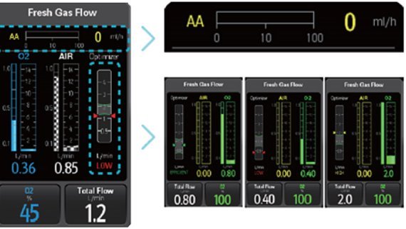 WATO EX-65 Pro Anesthesia System - Advanced Clinical Solutions for Anesthesiologists