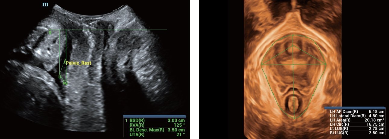 Mindray Resona 7 Premium Ultrasound System with ZONE Sonography Technology and Advanced Imaging Features