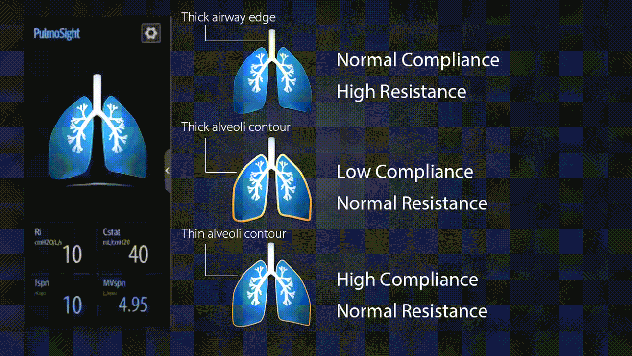 SV300 Pro Ventilator - Compact Intelligent Adaptive Respiratory Support Device for ICU and Patient Transport