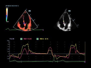 DC-80A Ultrasound System - High Clarity Imaging and Advanced Transducer Technology