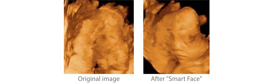 Z50 Color Doppler Ultrasound Machine