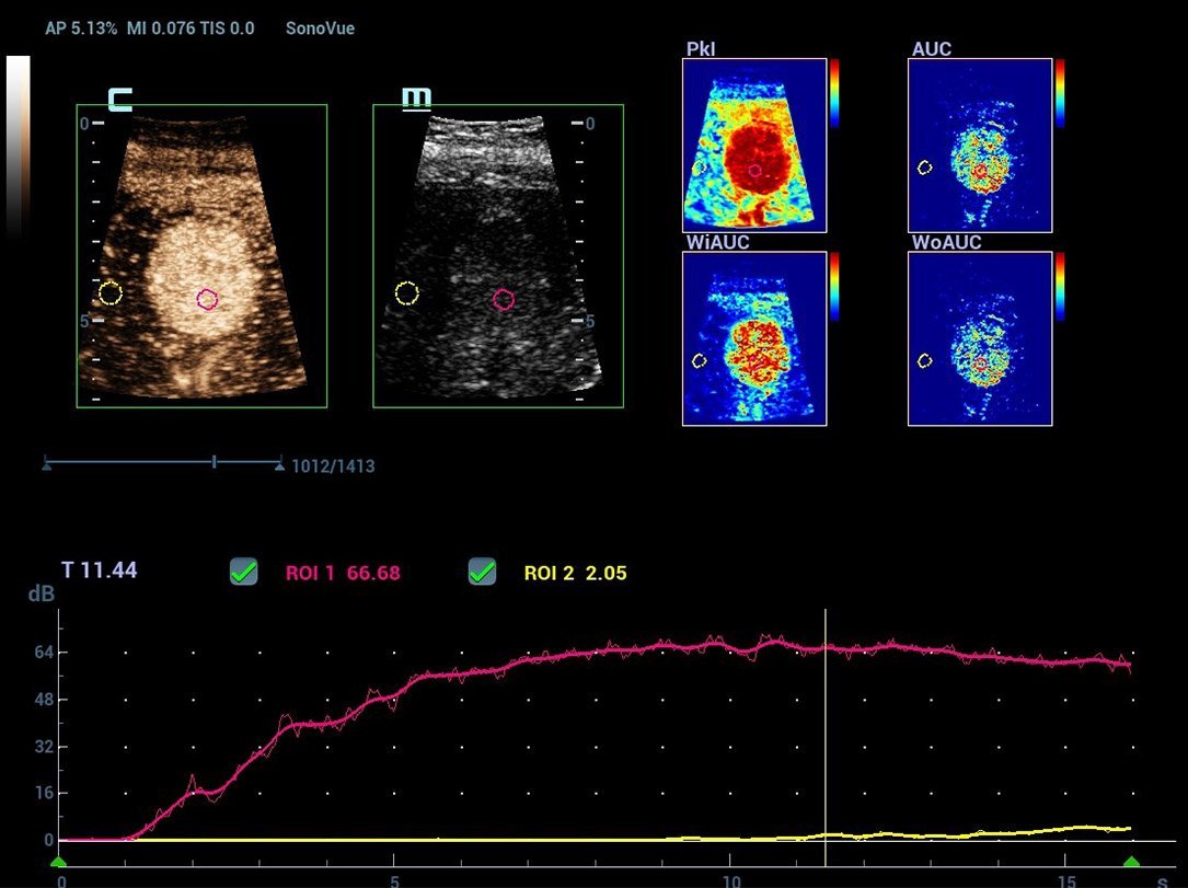 Resona R9 Platinum Edition Premium Ultrasound System for Radiology and Multi-Parametric Imaging Solutions