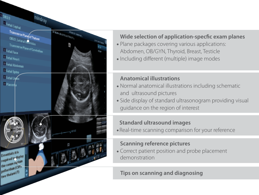 Mindray DC-40 Full HD Diagnostic Ultrasound System