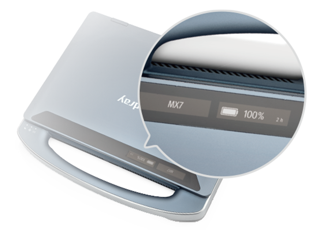 MX7 Ultrasound System - Advanced Mobile Imaging Solution