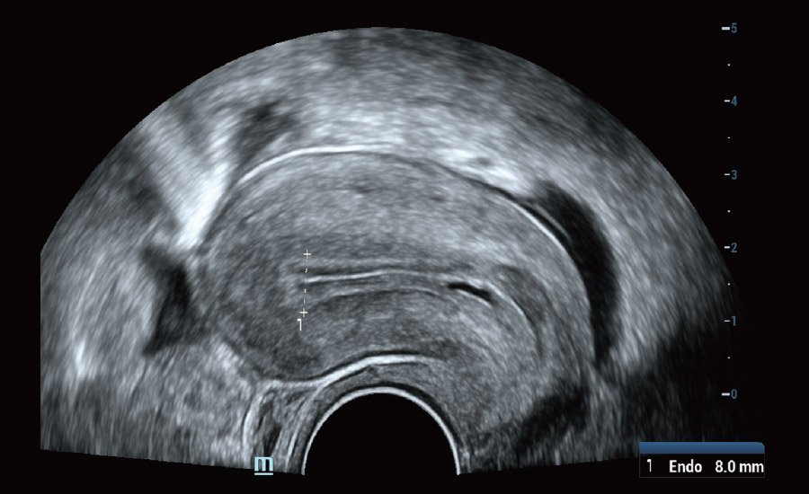 Nuewa R9 Platinum Edition Women's Healthcare Ultrasound System with Ultra-Micro Angiography Technology