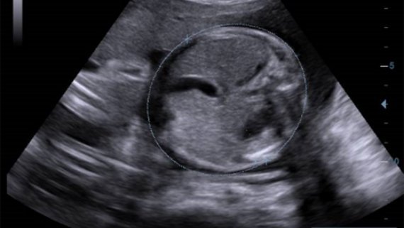 DC-40 Diagnostic Ultrasound System – Pure Crystal Technology for Primary Care