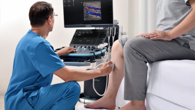 Resona I9 Diagnostic Ultrasound System - Advanced Imaging Technology for Clinical Solutions