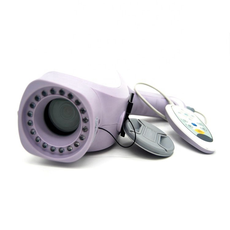 Portable Gynaecology Digital Colposcope System NEUCE07