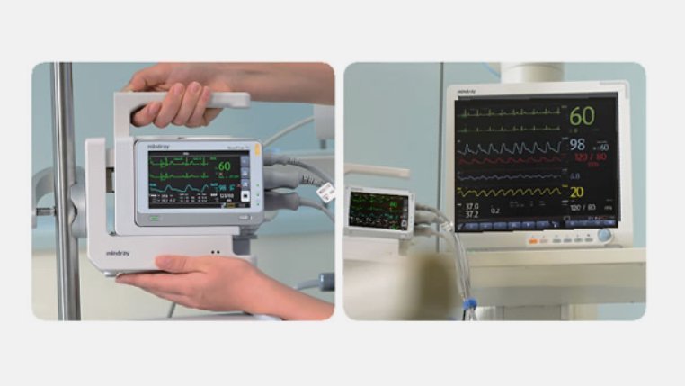 BeneView TDS Adaptive Modular Patient Monitoring System