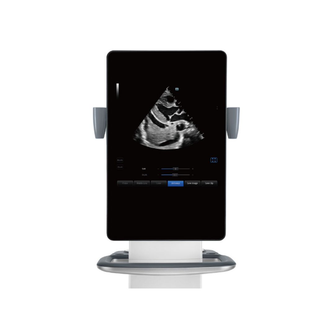 TE9 Ultrasound System for Anesthesia and Critical Care
