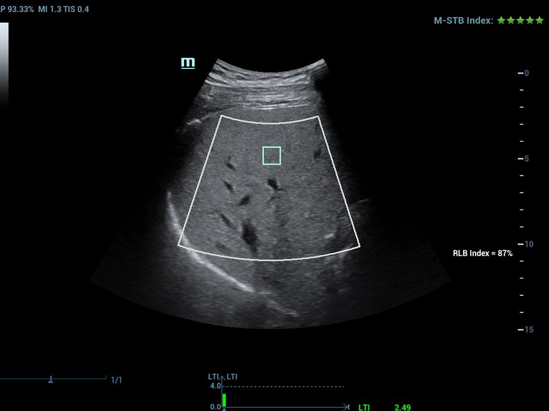 Resona R9 Platinum Edition Premium Ultrasound System for Radiology and Multi-Parametric Imaging Solutions
