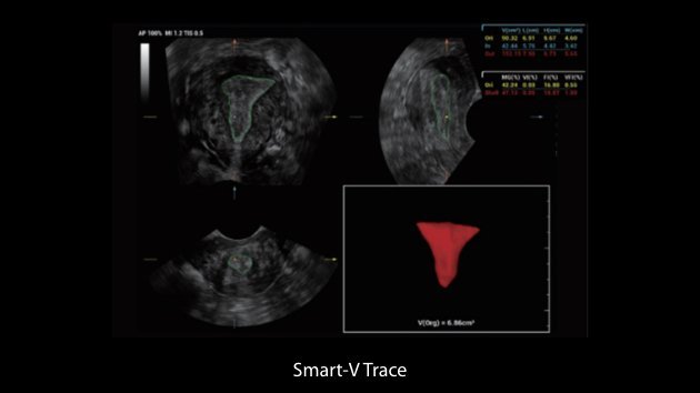Nueba I9 Women and Neonatal Healthcare Ultrasound Device with Advanced Imaging Technology