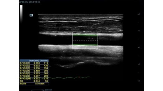 MX7 Ultrasound System - Advanced Mobile Imaging Solution