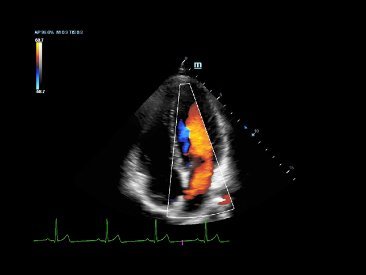 DC-80A Ultrasound System - High Clarity Imaging and Advanced Transducer Technology