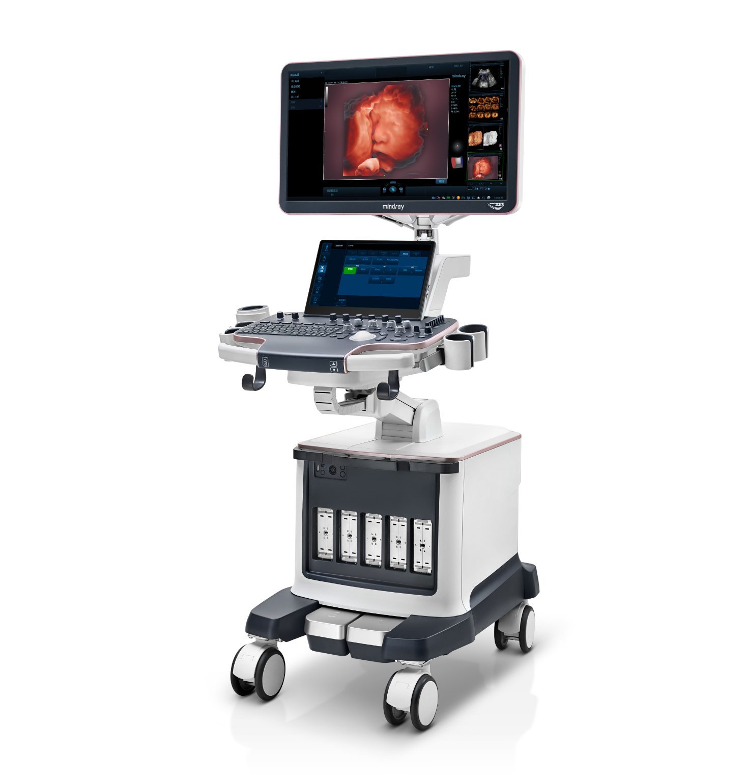 Nuewa R9 Platinum Edition Women's Healthcare Ultrasound System with Ultra-Micro Angiography Technology