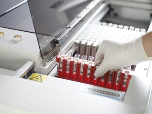 SAL 9000 Chemistry & Immunoassay Integrated System - High Throughput Lab Analyzer