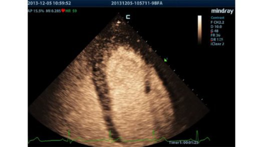 MX7 Ultrasound System - Advanced Mobile Imaging Solution