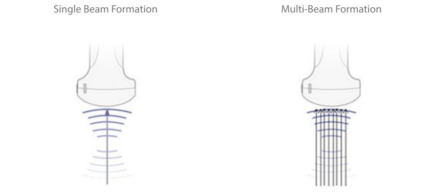 Mindray M6 Ultrasound System - Compact, Portable, and High-Performance Diagnostic Tool