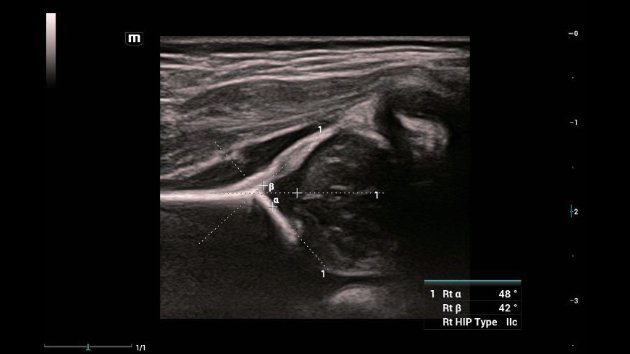 Consona N9 Comprehensive Ultrasound Imaging System